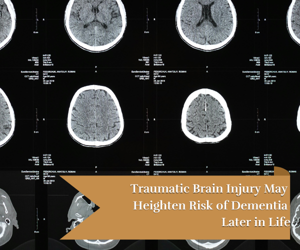results of a ct scan for the brain