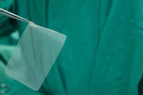 Doctor extracting a defective hernia mesh