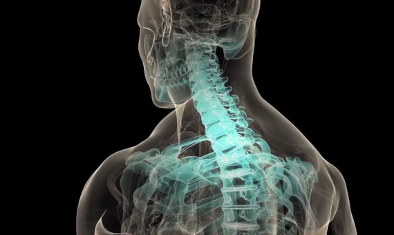 osteoporosis video thumbnail